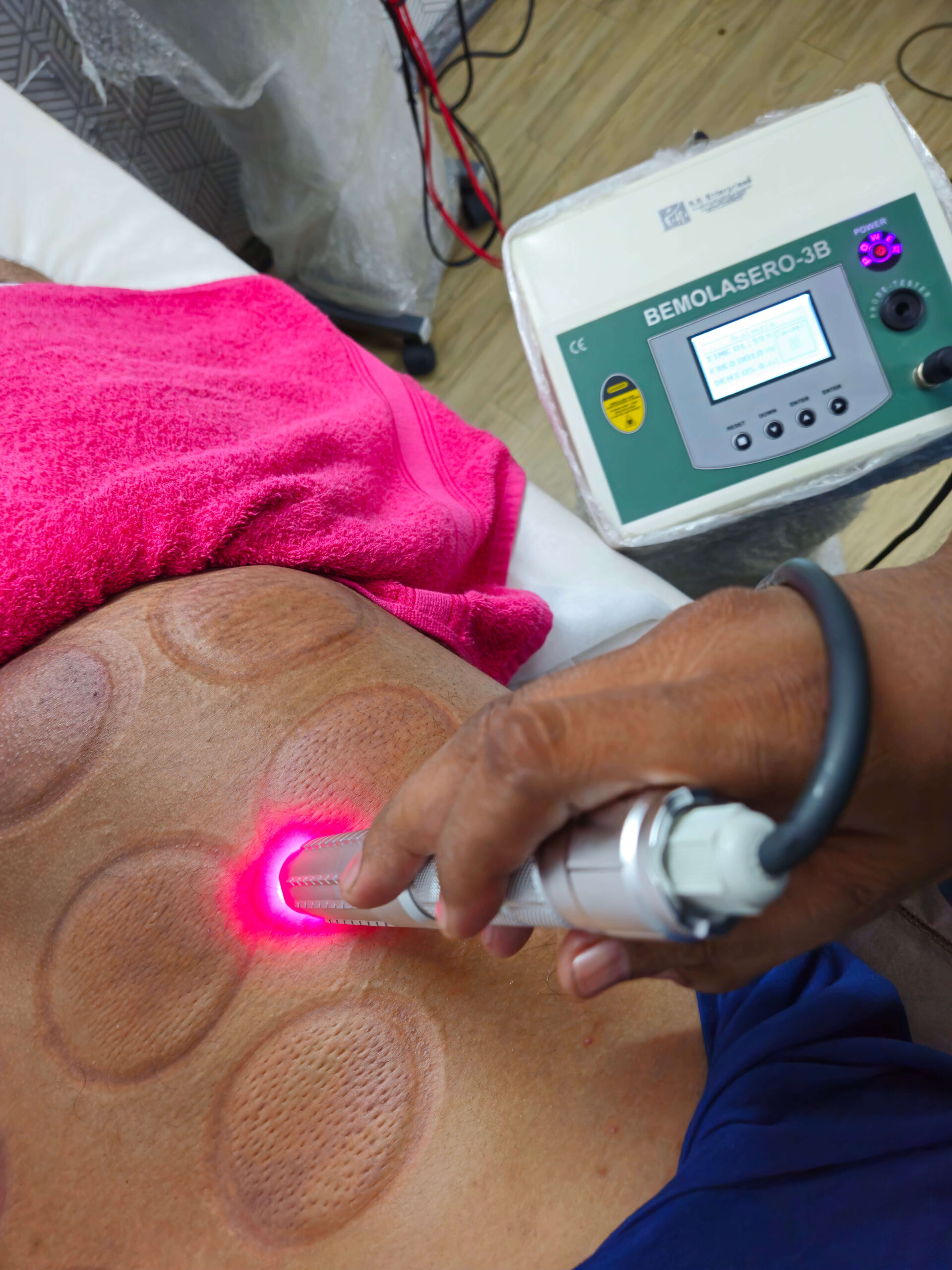 Patient receiving laser therapy on back at Jyosa Advance Physiotherapy Rohini